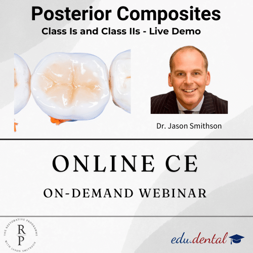 Featured image for “Posterior Composite Restorations”