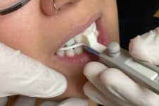 Dental Sleep Apnea CE - Mandibular Advancement Devices and Medical Biling