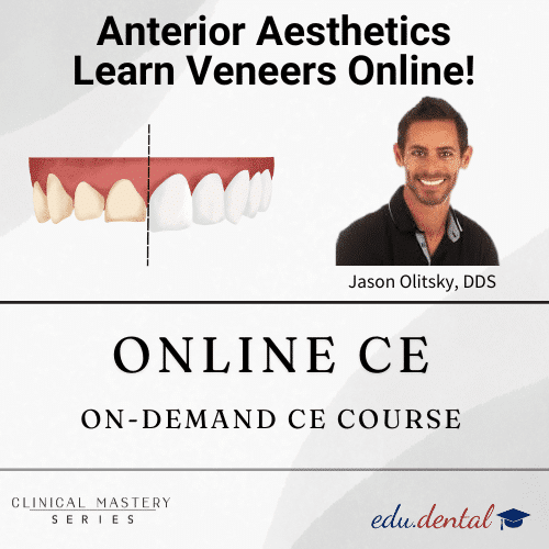 Featured image for “Anterior Aesthetics – Online Veneer CE Course”